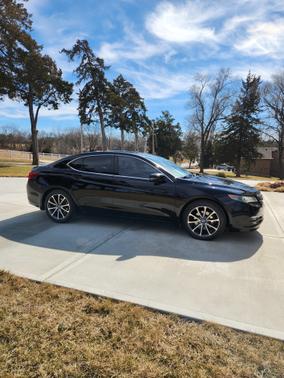 2016 Acura TLX V6 Tech