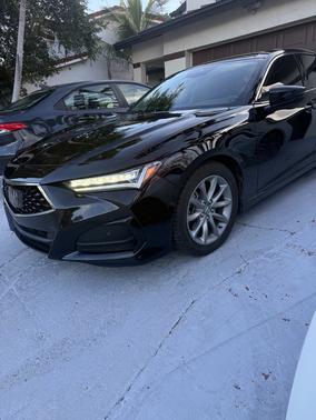 Black 2025 Acura TLX Technology