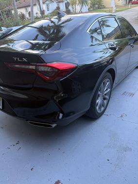 Black 2025 Acura TLX Technology
