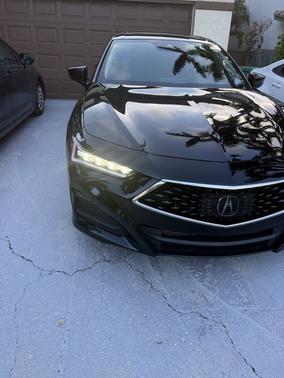 Black 2025 Acura TLX Technology