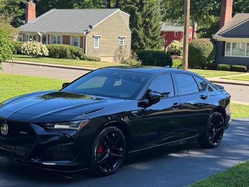 Black 2025 Acura TLX Type S