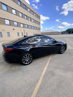 Black 2016 Acura TLX V6 Tech