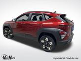 Thumbnail of 2025 Ultimate Red Metallic Hyundai KONA