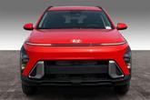 Thumbnail of 2025 Soultronic Orange Pearl Hyundai KONA