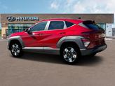 Thumbnail of 2025 Ultimate Red Metallic Hyundai KONA