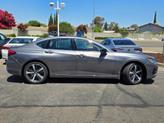Thumbnail of 2025 Liquid Carbon Metallic Acura TLX