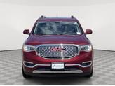 Thumbnail of 2018 Crimson Red Tintcoat GMC Acadia