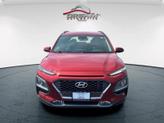Thumbnail of 2021  Hyundai KONA