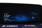 Thumbnail of 2025 White Hyundai ELANTRA HEV