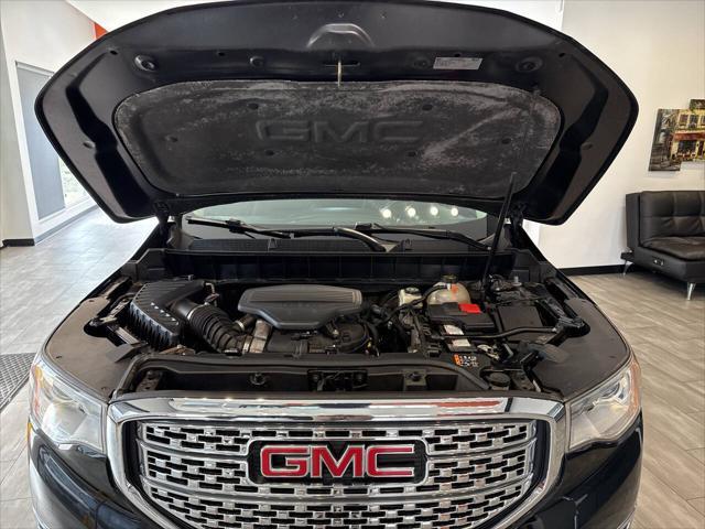 Photo of 2017 Black GMC Acadia
