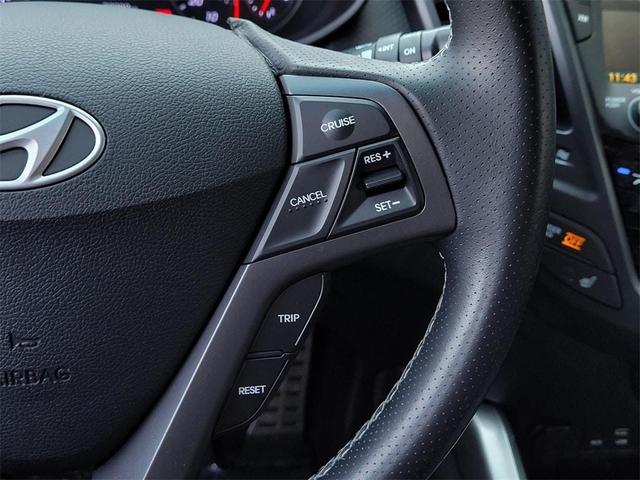 Photo of 2016 Vitamin C Hyundai Veloster