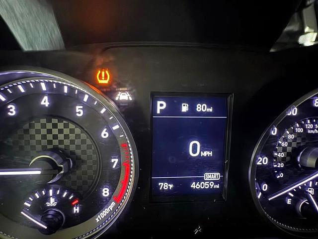 Photo of 2020 Black Hyundai ELANTRA