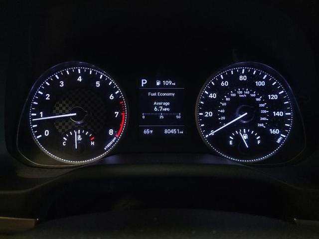 Photo of 2019 Phantom Black Hyundai ELANTRA