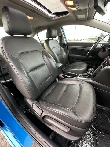 Photo of 2017 Electric Blue Hyundai ELANTRA