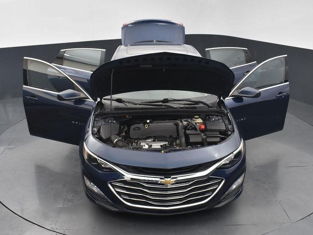 Photo of 2022 Northsky Blue Metallic Chevrolet Malibu