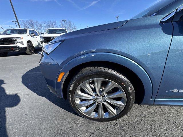 new 2026 Buick Envista car, priced at $31,359